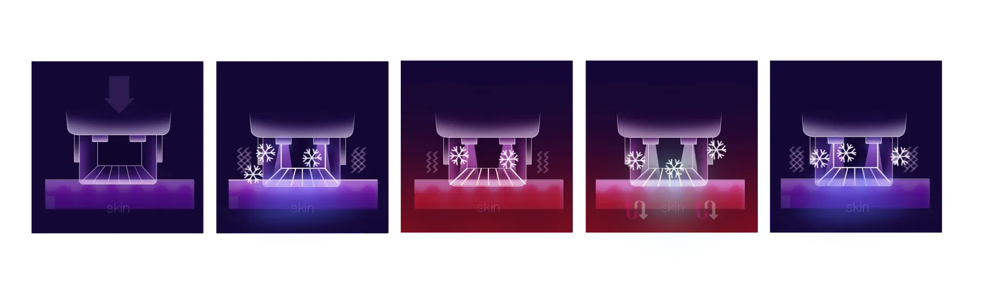 Gangnam Thermage FLX — device imagery